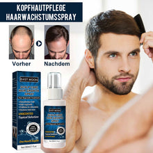 Laden Sie das Bild in den Galerie-Viewer, Kopfhautpflege-Haarwuchsspray