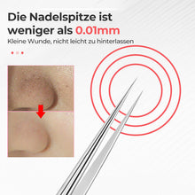 Laden Sie das Bild in den Galerie-Viewer, Professionelle Pinzette zum Entfernen von Mitessern im Gesicht