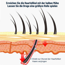 Laden Sie das Bild in den Galerie-Viewer, Kopfhautpflege-Haarwuchsspray