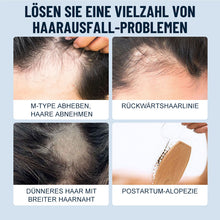 Laden Sie das Bild in den Galerie-Viewer, Kopfhautpflege-Haarwuchsspray