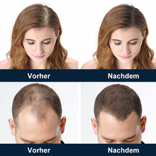 Laden Sie das Bild in den Galerie-Viewer, Kopfhautpflege-Haarwuchsspray