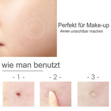 Laden Sie das Bild in den Galerie-Viewer, Aknen Aufkleber, 30 Stücke