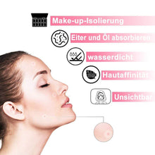 Laden Sie das Bild in den Galerie-Viewer, Aknen Aufkleber, 30 Stücke