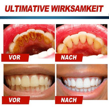 Laden Sie das Bild in den Galerie-Viewer, Intensive Fleckenentfernung Whitening Zahnpasta
