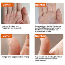 Laden Sie das Bild in den Galerie-Viewer, Rissfeste Creme für die Winterhaut
